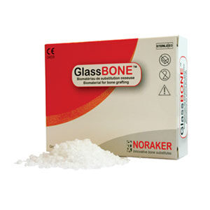 Glassbone